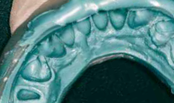 Нанесение Хонигум Моно - этап 2